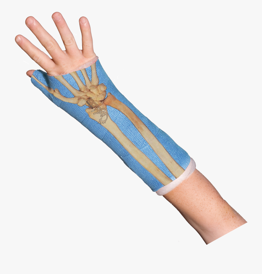 Bones Wrist Bones Casttoo Orthopedic Cast Tattoos Gif - Orthopedic Cast, Transparent Clipart