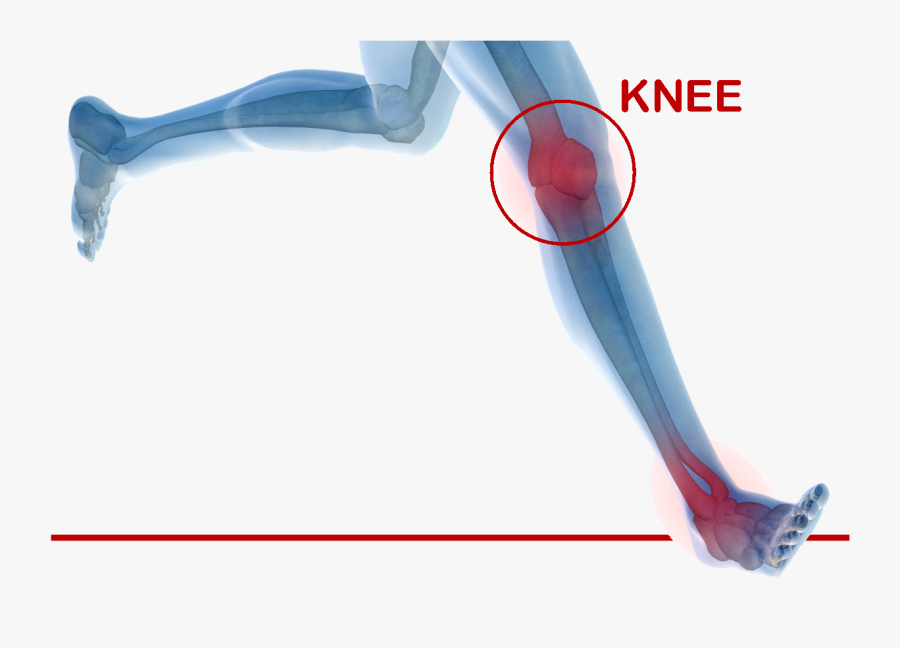 A Study Reviews The Quality Of Life In Patients After - Knee Joint Replacement Png, Transparent Clipart