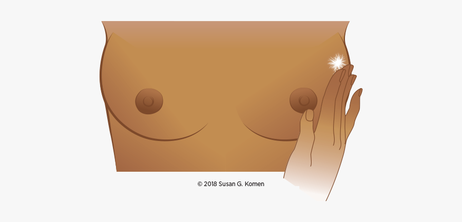 Lumpy Thickening In Breast, Transparent Clipart