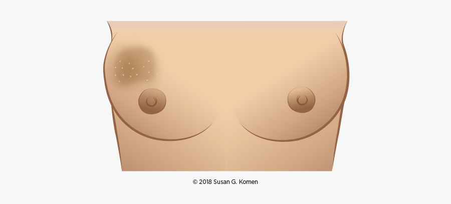 Darkening Around Breast, Transparent Clipart