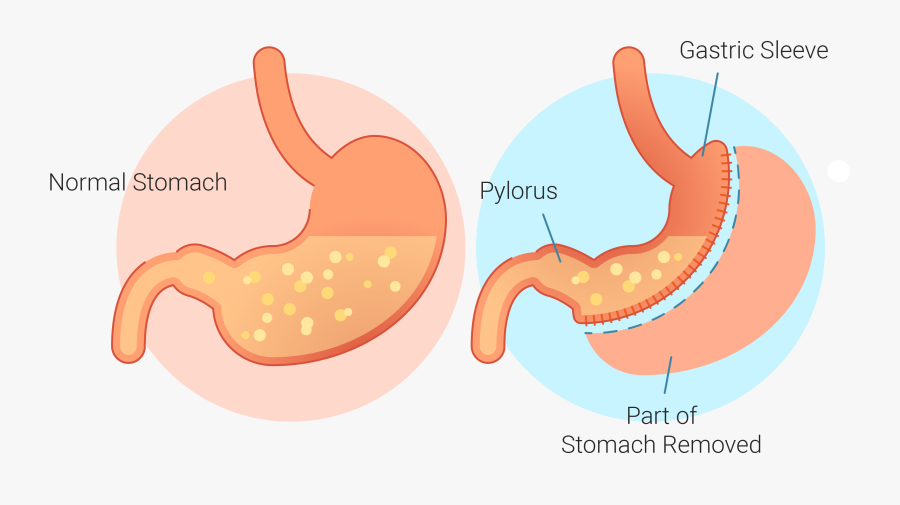Stomach Clip Art, Transparent Clipart