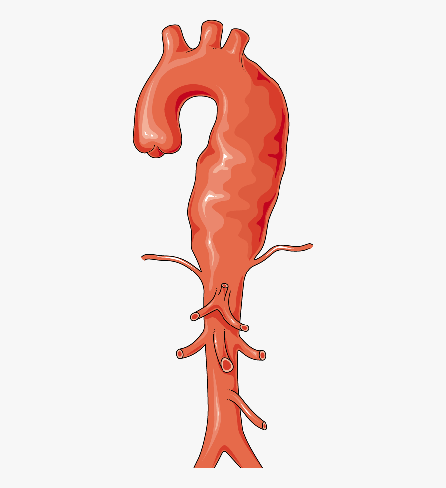 Anévrisme, Transparent Clipart