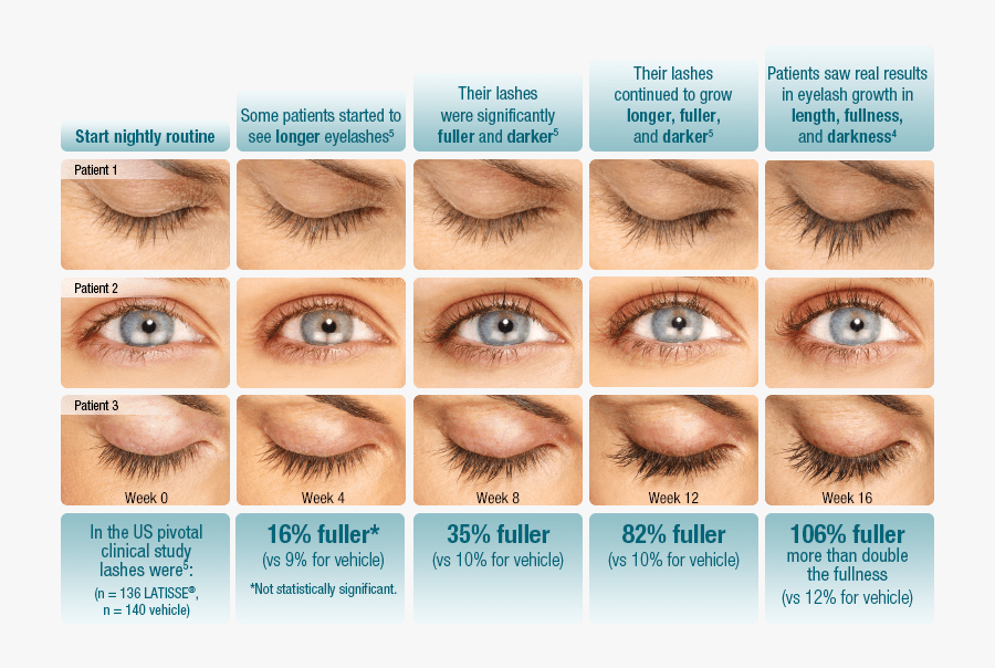 Lash Fullness Chart - Double Eyelashes Vs Normal, Transparent Clipart
