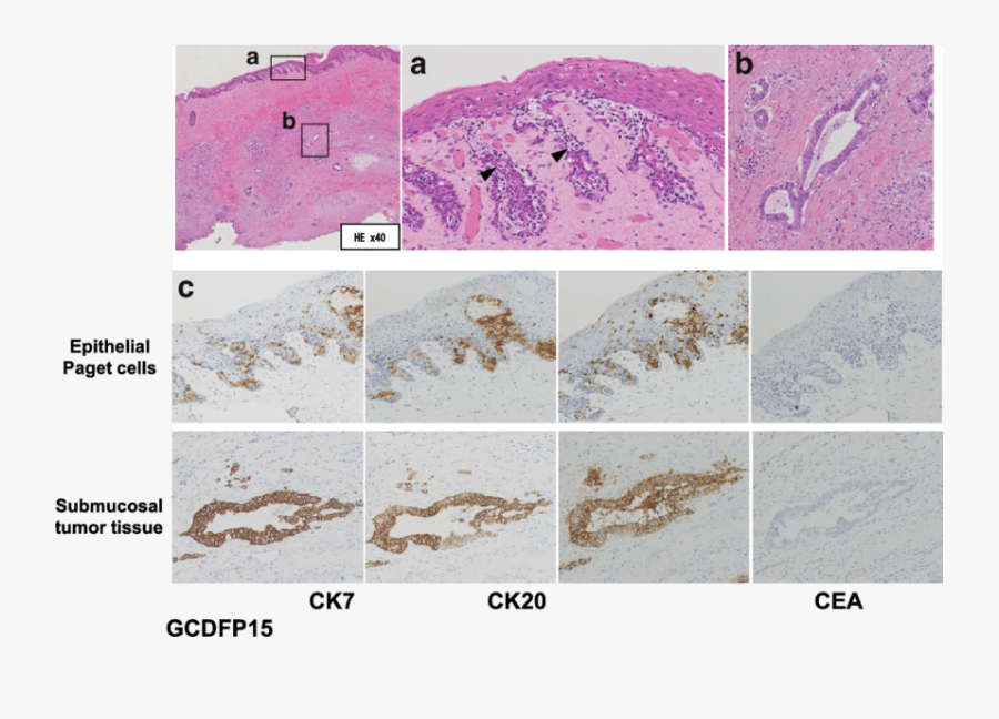 Transparent Arrow Head Png - Art, Transparent Clipart