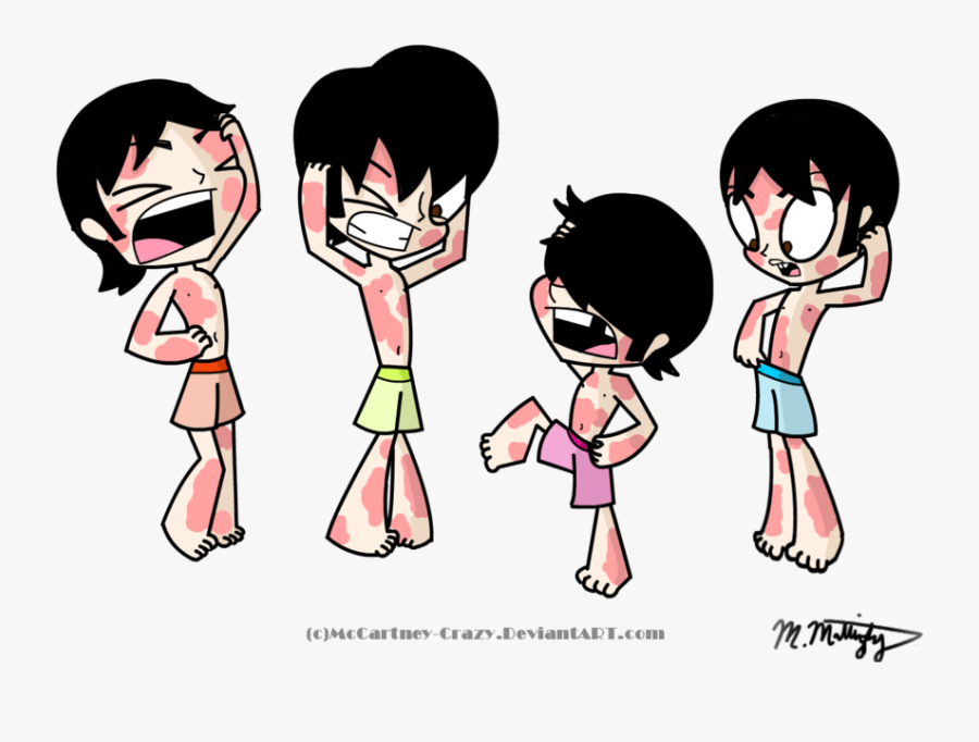 Itchy Rash Clipart - Skin Disease Cartoon Png, Transparent Clipart