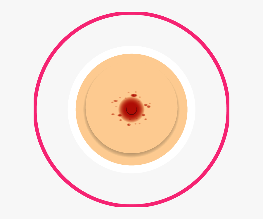 Nipple Rash - Circle, Transparent Clipart