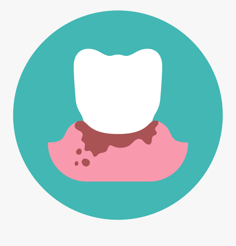 Home Diem Dental East - Bleeding Gum Clipart Png, Transparent Clipart
