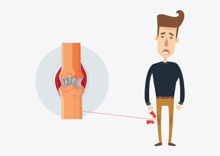 Transparent Knee Clipart - Cartoon, Transparent Clipart