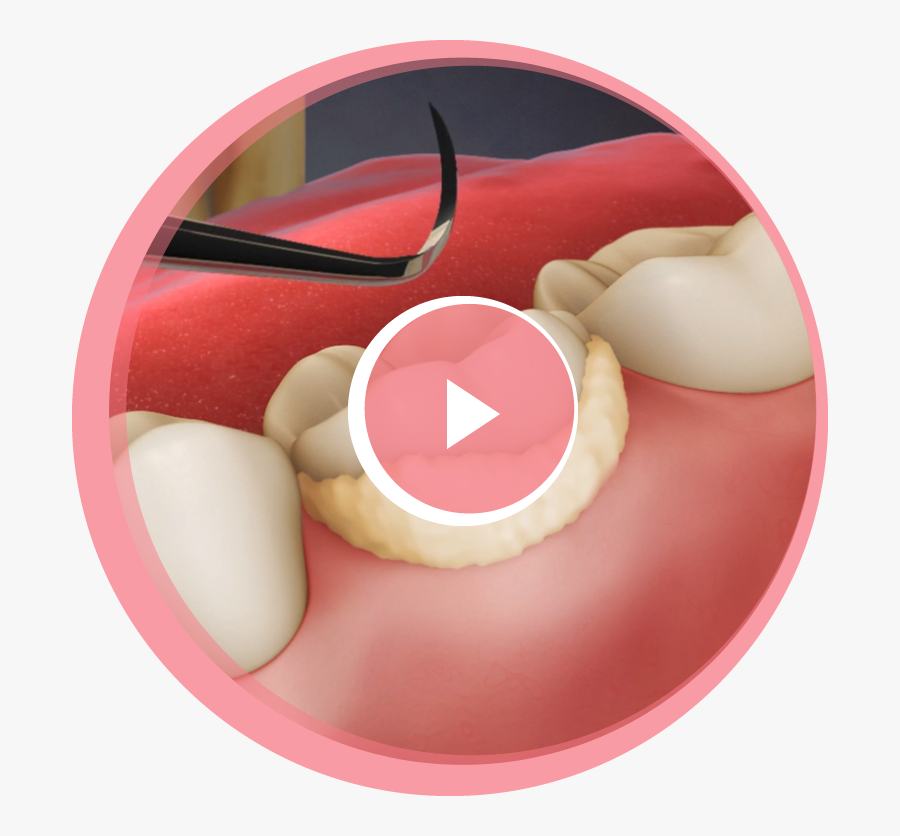 Circle, Transparent Clipart