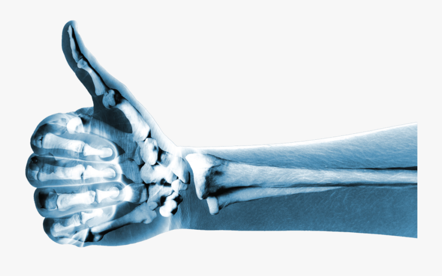See The Difference Your Wallet Will - Bone Fractures Fracture, Transparent Clipart
