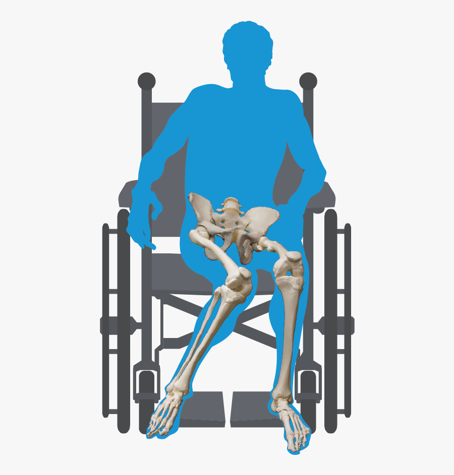 Wheelchair Seating For Pelvic Obliquity, Transparent Clipart