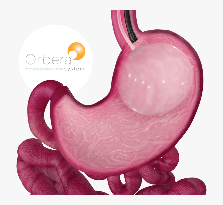 Orbera Weight Loss, Transparent Clipart
