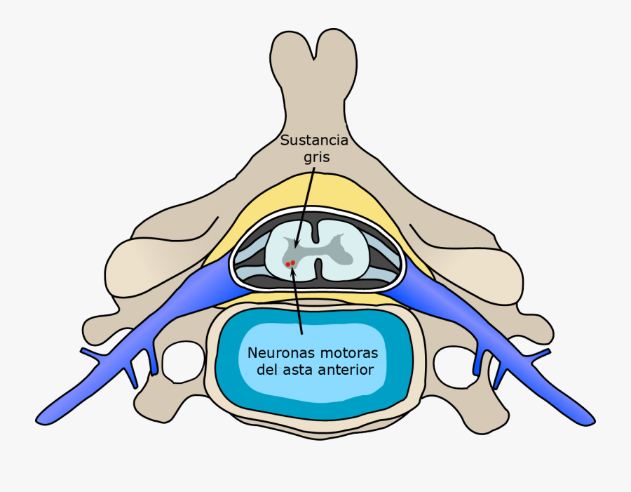 Polio Spinal Diagram Es - Spinal Muscular Atrophy Anatomy, Transparent Clipart