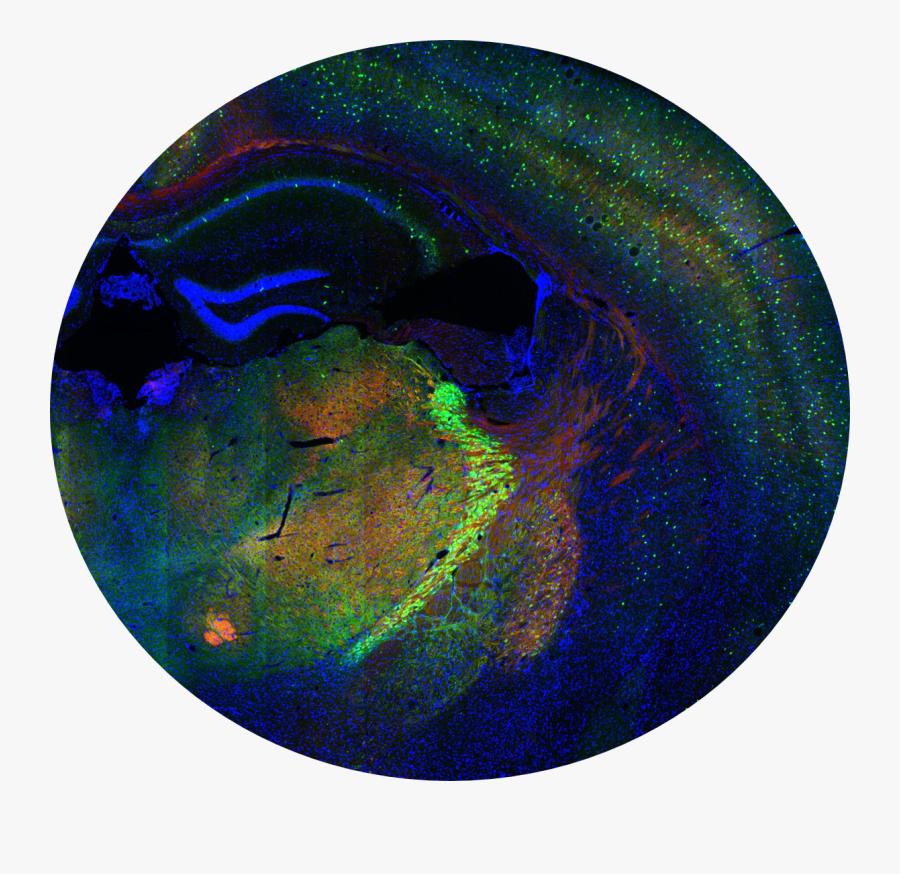 One Of Four Images Exemplifying Allen Institute Data - Allen Brain Map Atlas, Transparent Clipart