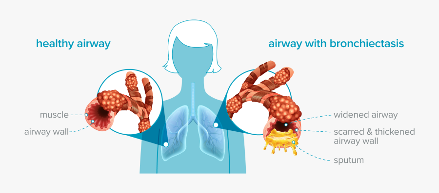 Image - Illustration, Transparent Clipart