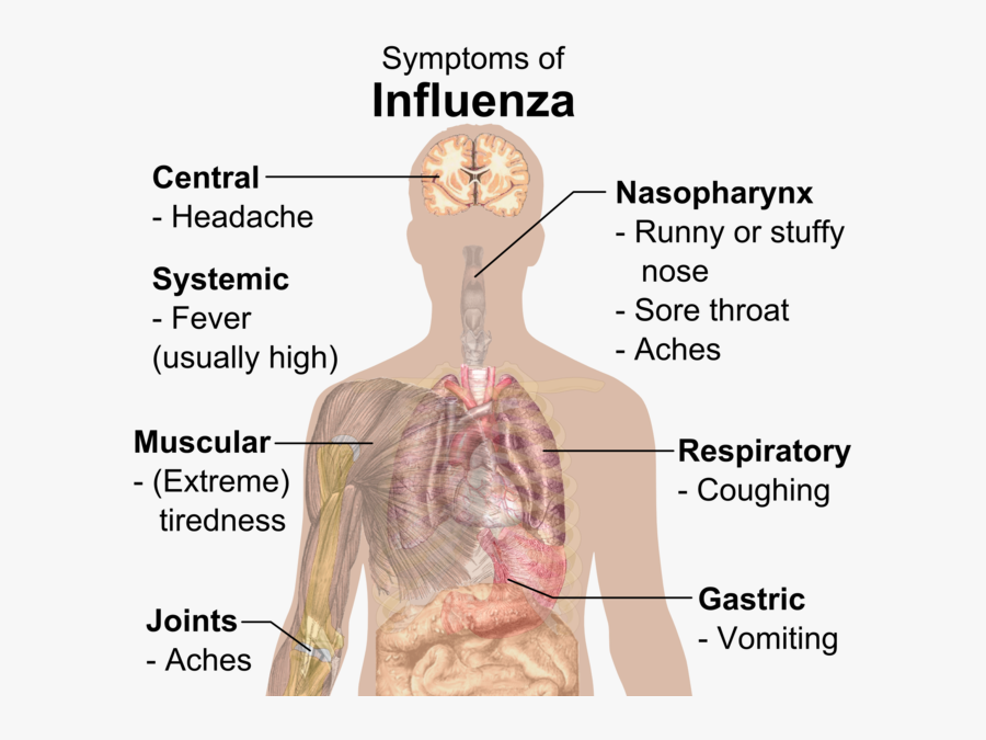 Clip Art Flu And Back Pain - Influenza Flu, Transparent Clipart