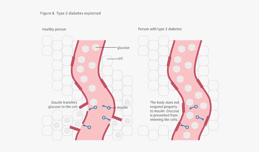 Figure8 - Type 2 Diabetes Vs Healthy Person, Transparent Clipart
