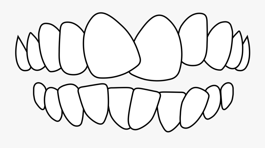Crooked Teeth, Transparent Clipart