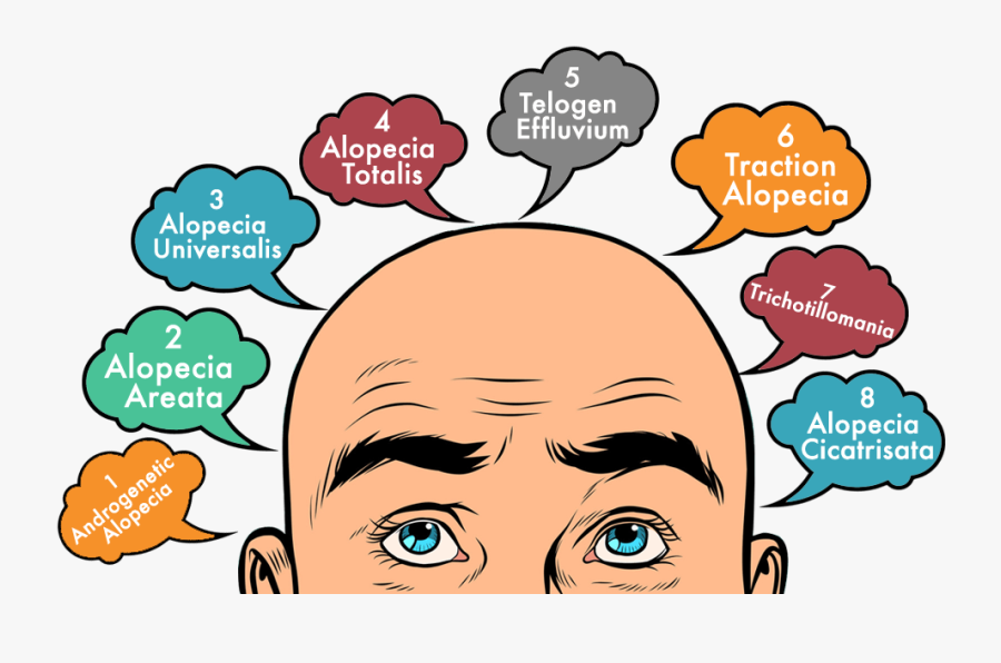 Types Of Hair Loss You Must Learn About - Bald Is Better Than Man Bun, Transparent Clipart