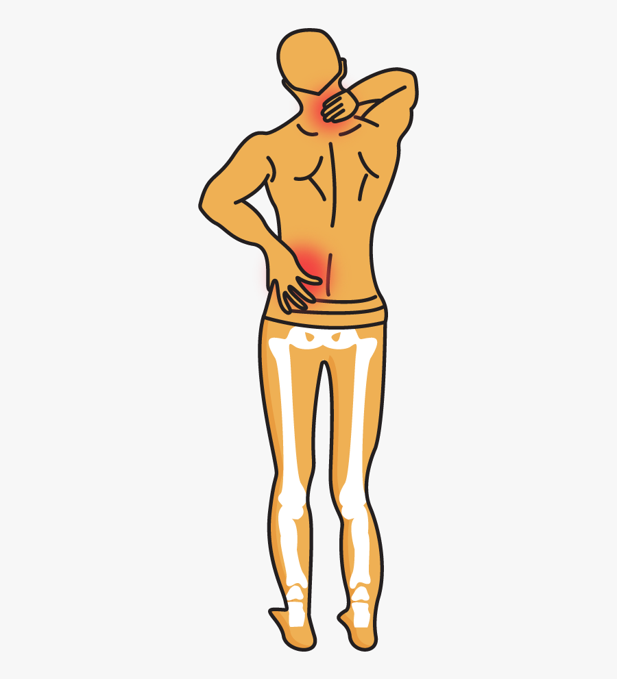Fallen Arch And Back Pain, Transparent Clipart