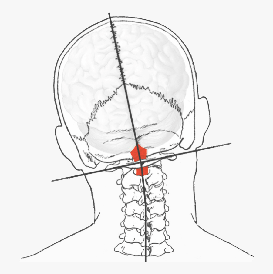 Dizzy Clipart 105991 , Png Download - Upper Neck Pain, Transparent Clipart