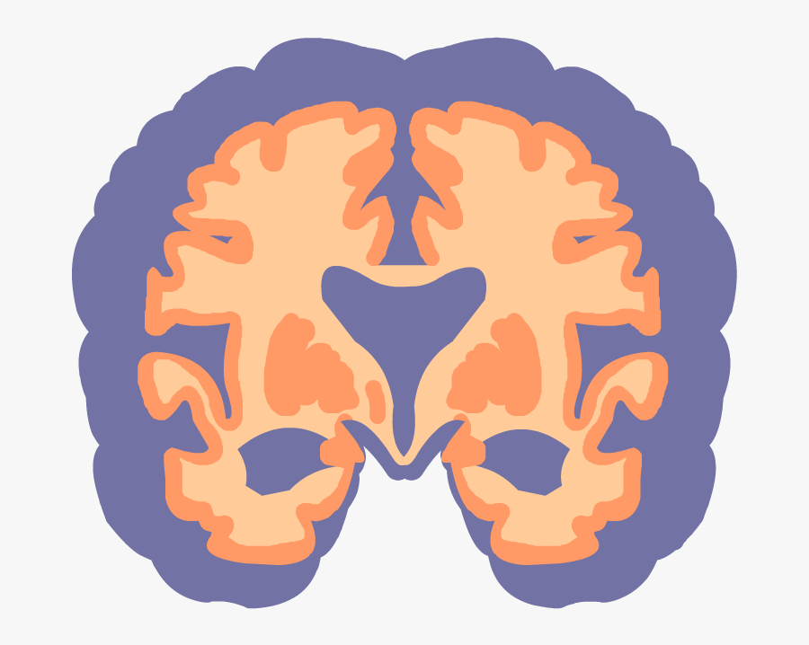 Alzheimer's Brainpop, Transparent Clipart