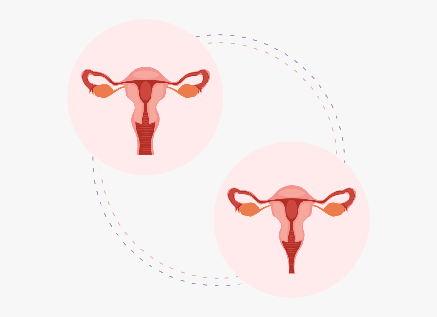 Pelvic Inflammatory Disease Anatomy, Transparent Clipart