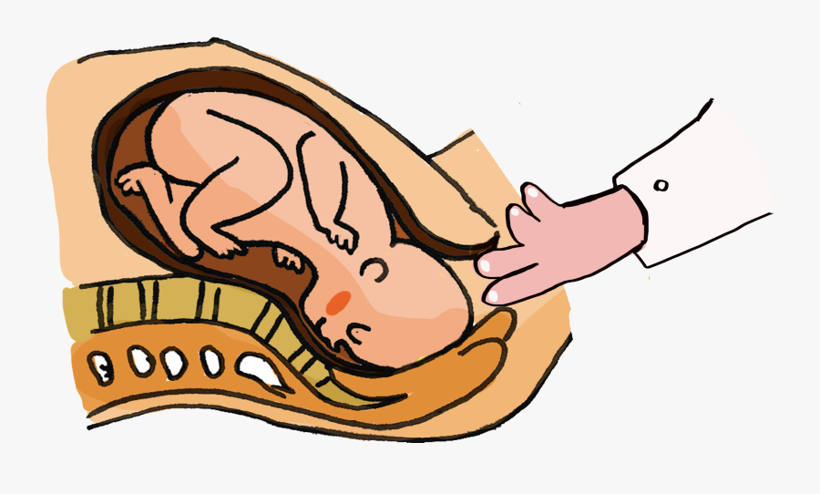 Tacto Vaginal En Embarazada, Transparent Clipart