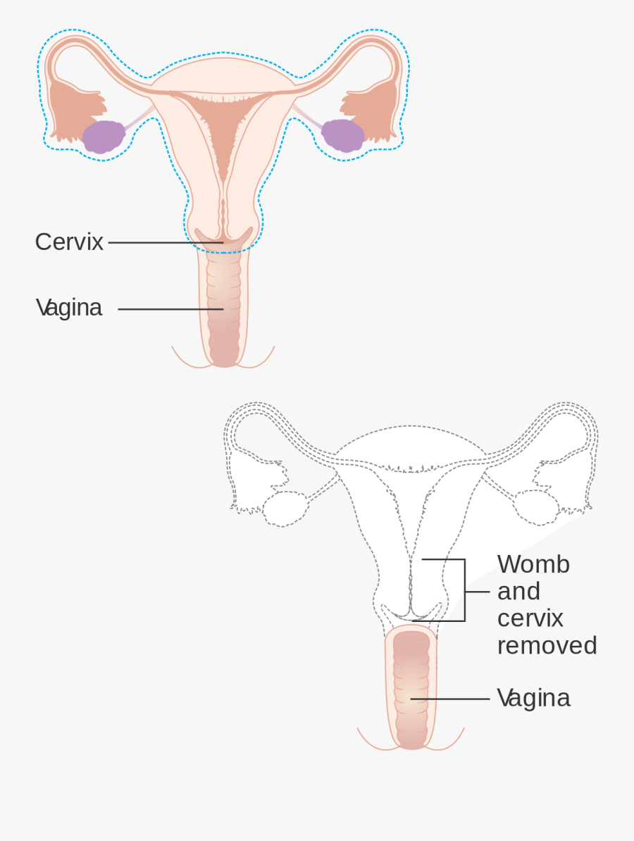Post Op Trans Woman, Transparent Clipart