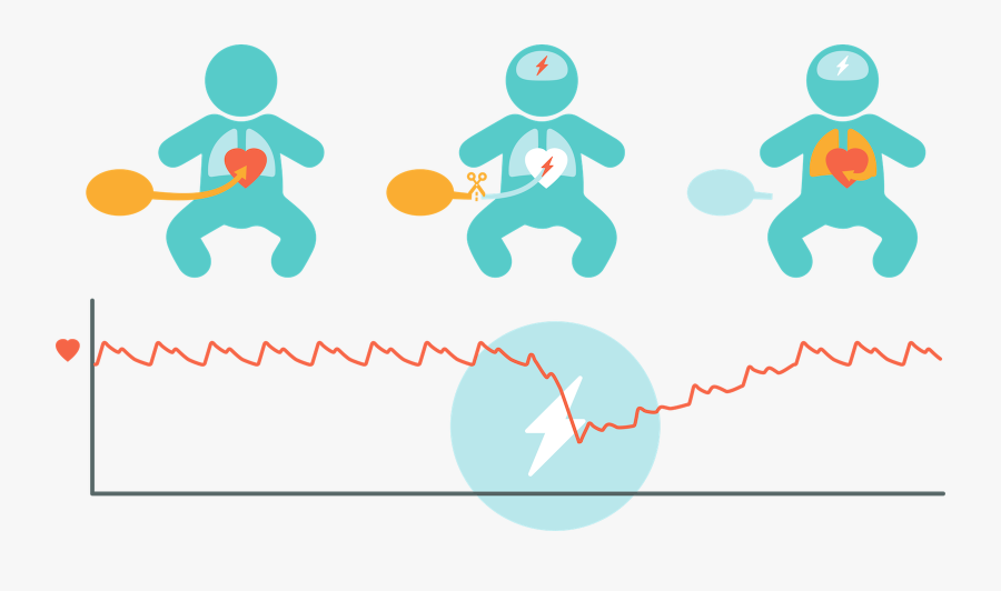 Asphyxia In Neonates Clipart, Transparent Clipart