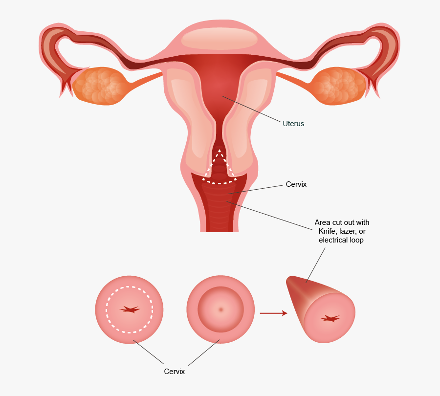 Female Reproductive System Clipart, Transparent Clipart