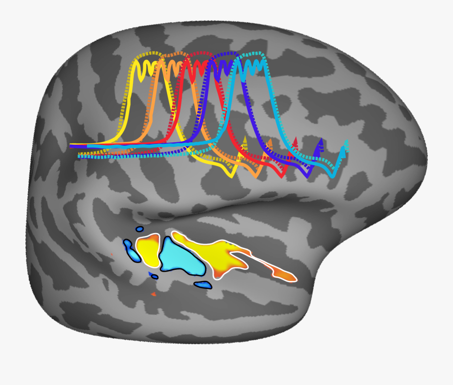 Brain Clipart Dementia - L Attivazione Della Corteccia Uditiva Nell Uomo Nella, Transparent Clipart