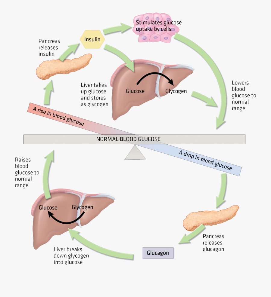 Hyperglycemia Results - Hyperglycemia Insulin, Transparent Clipart