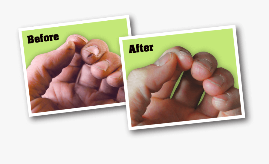 Transparent Before And After Clipart - O Keeffe's Working Hands Hand Cream, Transparent Clipart