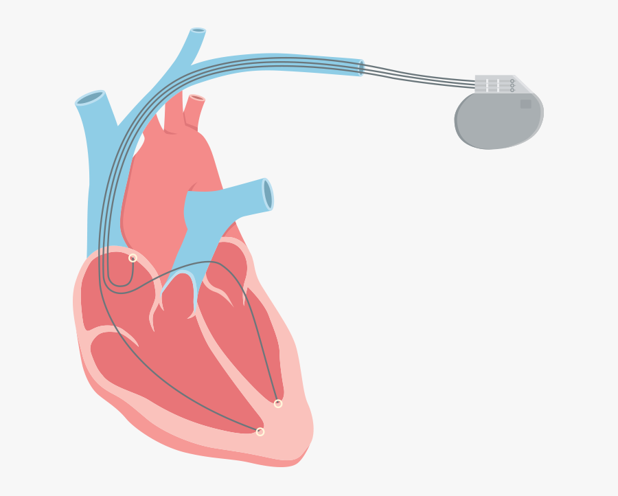 Heart Failure Png, Transparent Clipart