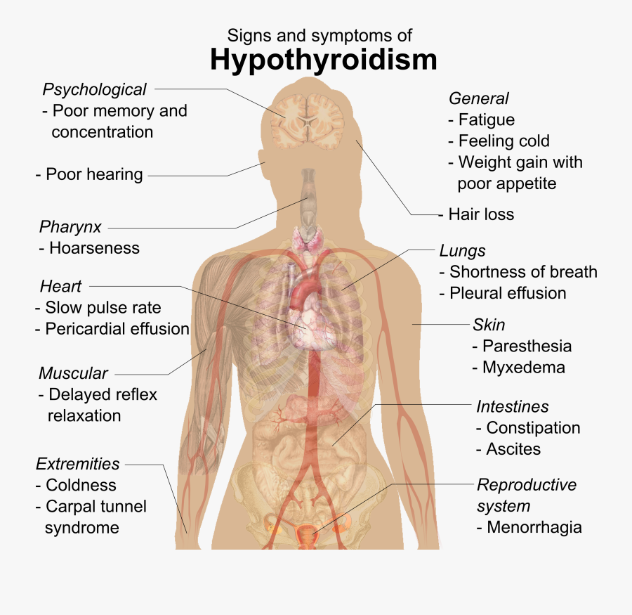 Signs And Symptoms Of Hypothyroidism - Male Hypothyroidism Hair Loss, Transparent Clipart