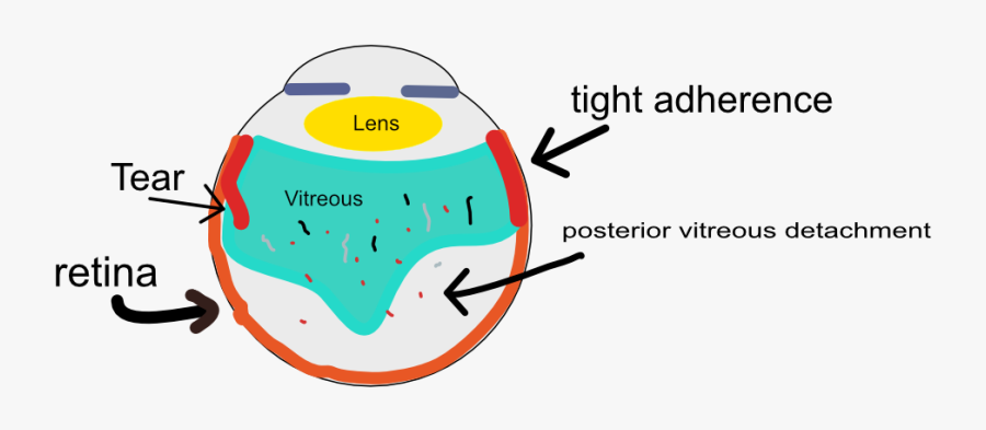 Eye Arc Of Flashing Light In Eye, Transparent Clipart