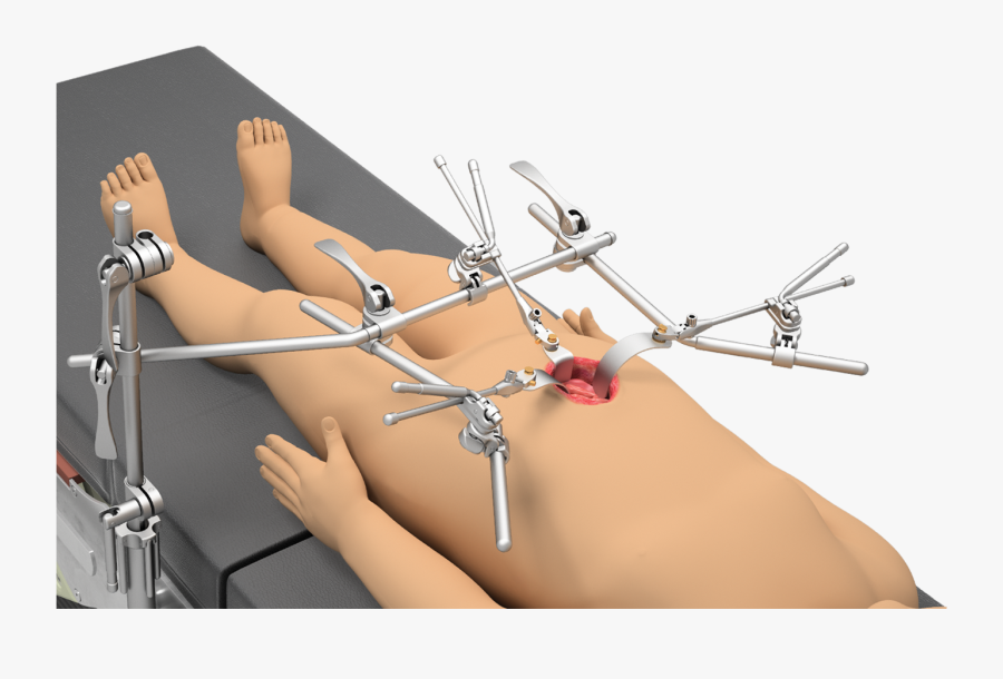 Thompson Pediatric Retractor, Transparent Clipart