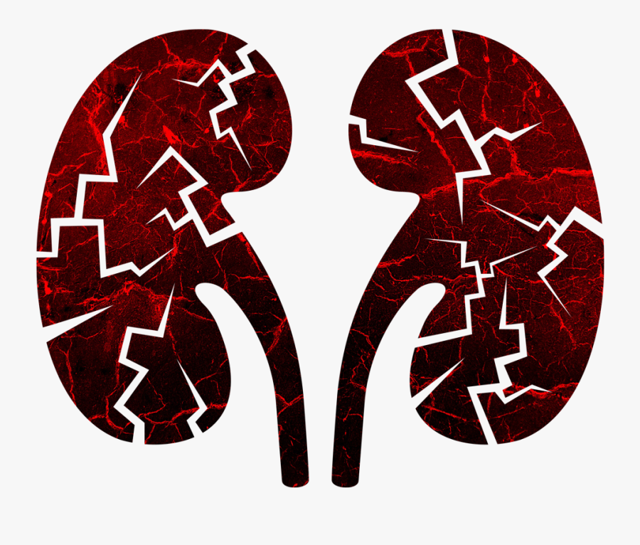 Kidney Damage, Transparent Clipart