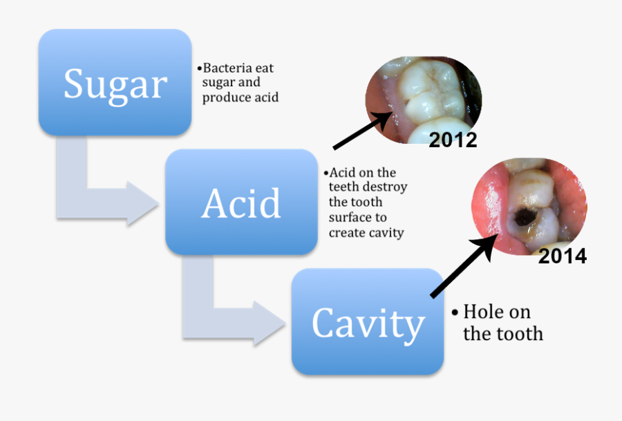 Cavities - Bible Verse Numbers 14 28, Transparent Clipart