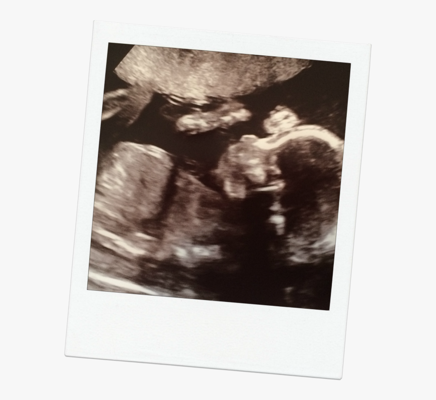 Clip Art Boy Ultrasound Images - Photograph, Transparent Clipart