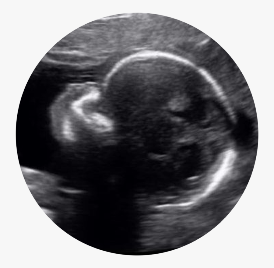 Circle, Transparent Clipart