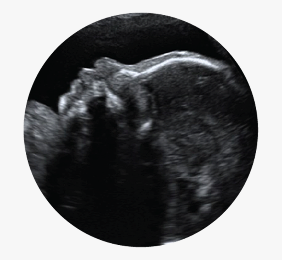 Prenatal Ultrasound Clipart, Transparent Clipart