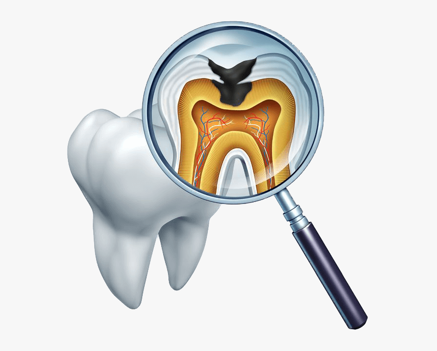 General Dentistry Jenny Ngai - Root Canal Treatment Png, Transparent Clipart