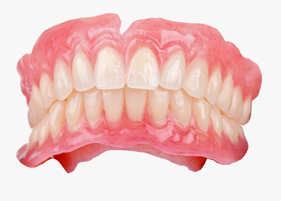 Why You Should Learn To Love Providing Dentures - Dental Denture, Transparent Clipart