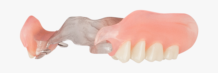 Clip Art Dentures Images - Flexible Upper Partial Dentures, Transparent Clipart