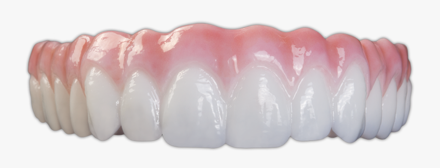 Im0404 Bruxzir Implant Prosthesis Spotlight Hd - Clear Choice Dental Implants, Transparent Clipart