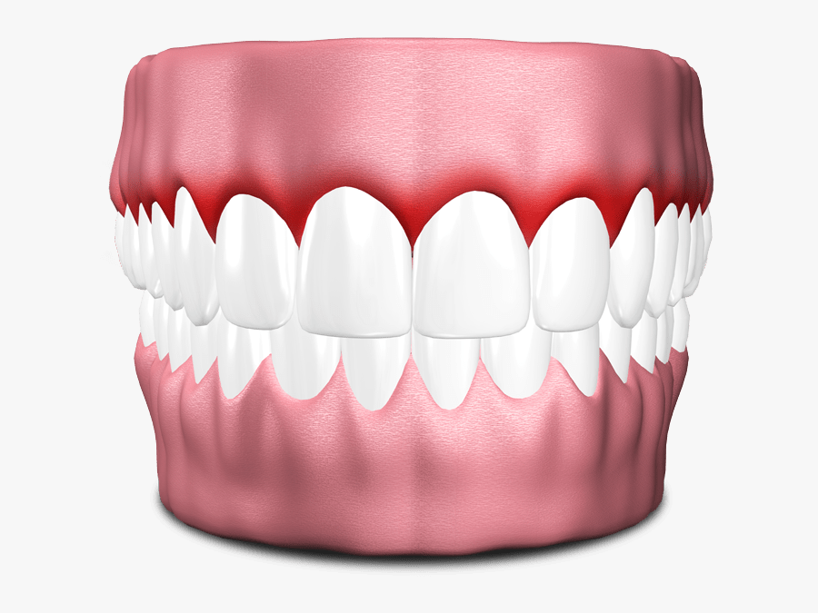 Dental Implants Model San Jose, Ca - Tooth Gum Png, Transparent Clipart