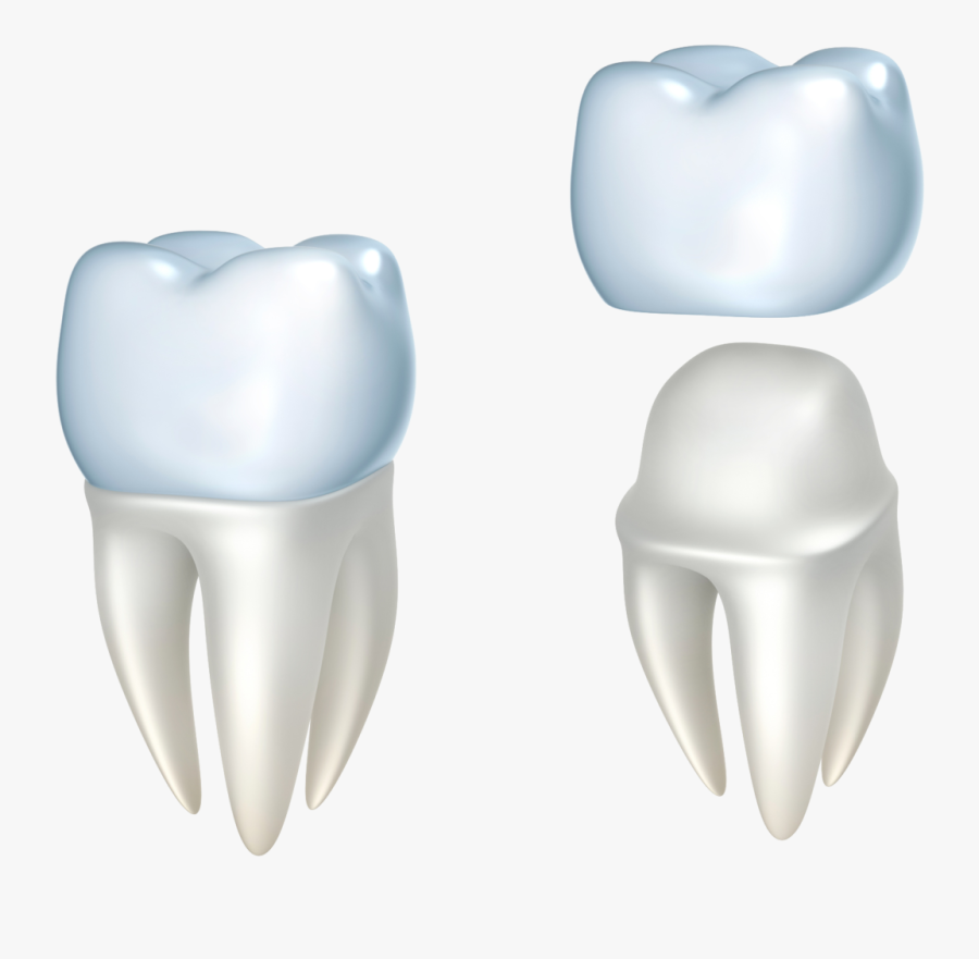 Dental Crown Model Baltimore Md - Tooth Crown Png, Transparent Clipart