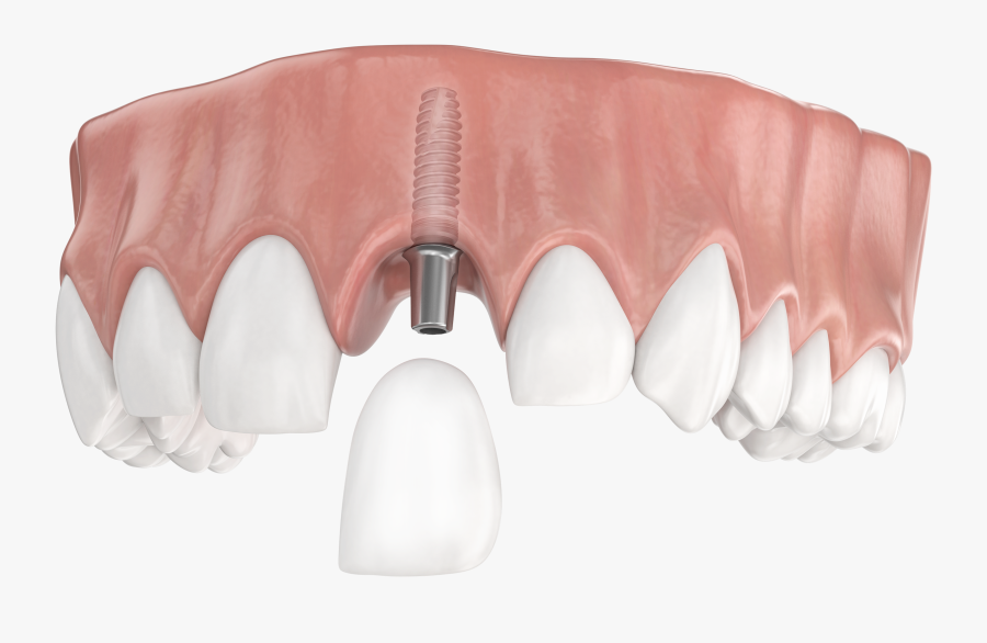 Picture Of A Tooth - Tongue, Transparent Clipart
